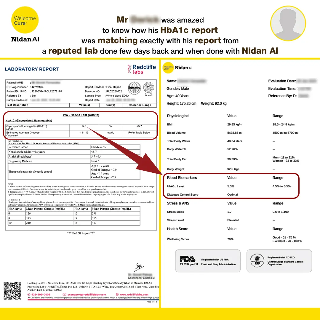 HbA1c report at home