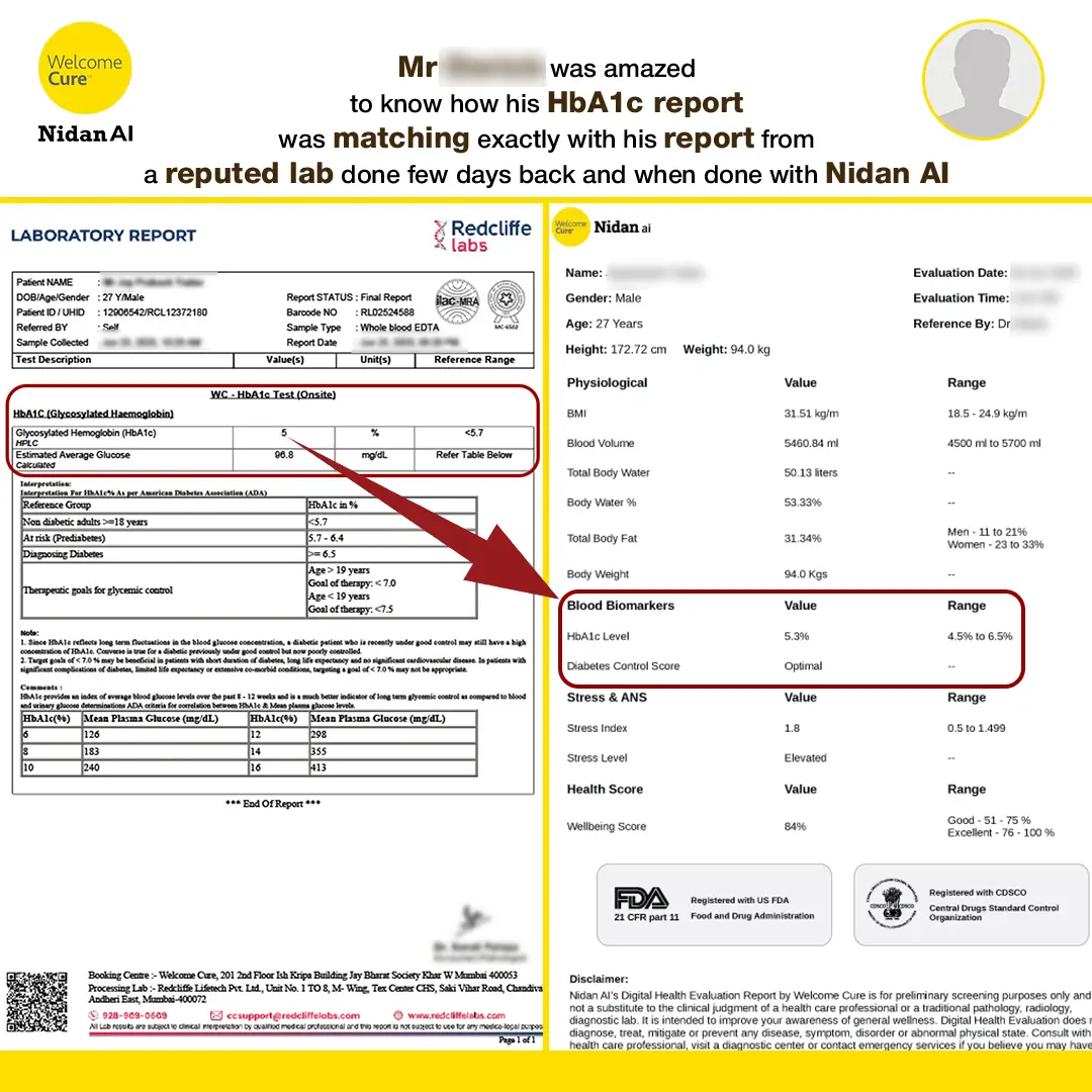 HbA1c repot comparation