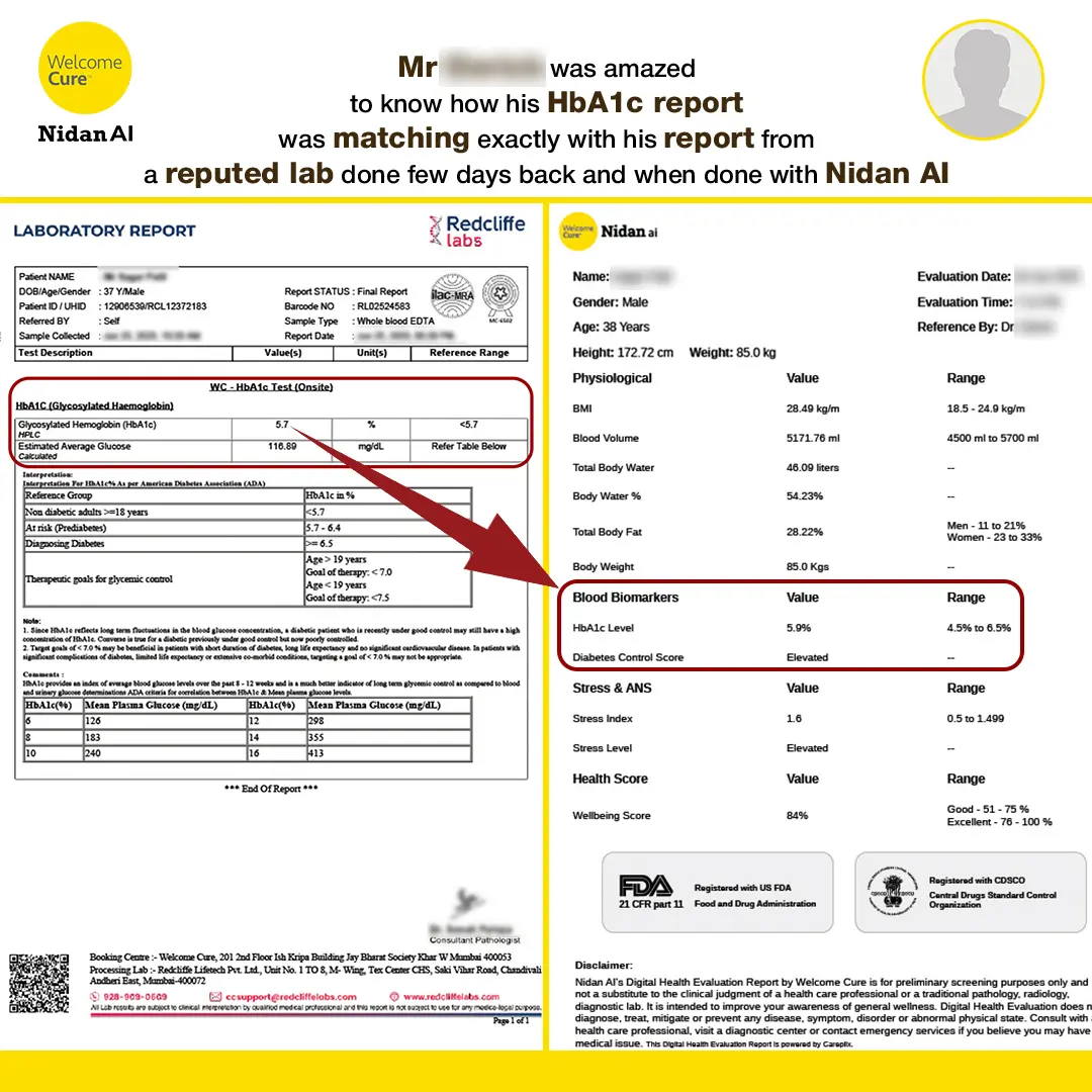 HbA1c report at home