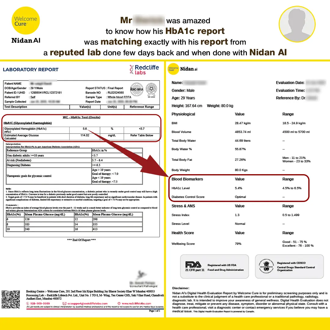 HbA1c report at home